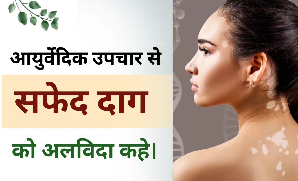 आयुर्वेदिक उपचार से